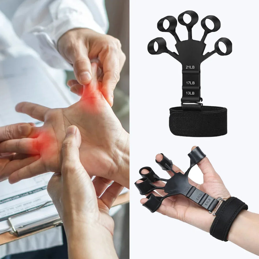 Novara Forearm Protocol